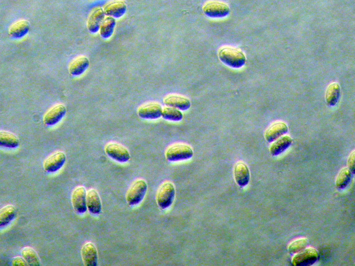 Sistotrema octosporum?