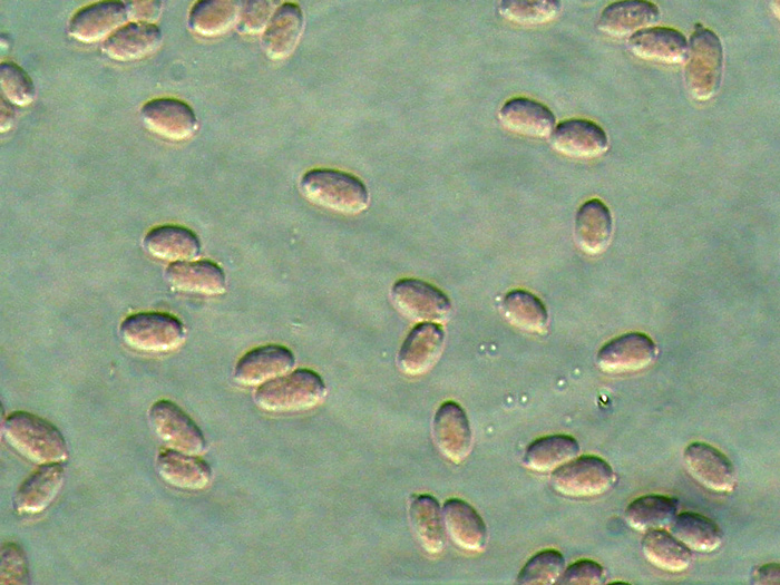 Sistotrema octosporum?