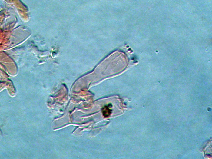 Sistotrema octosporum?