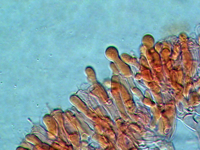 Sistotrema octosporum?