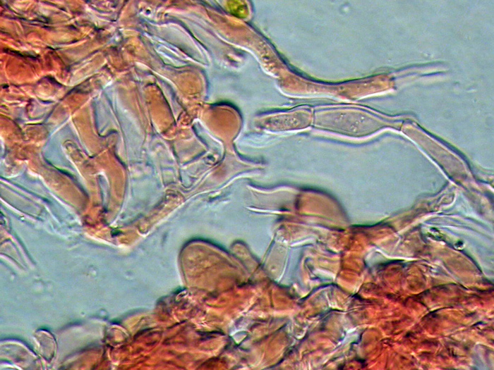 Sistotrema octosporum?