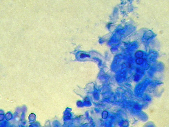 Trechispora cohaerens - (Cristinia helvetica)