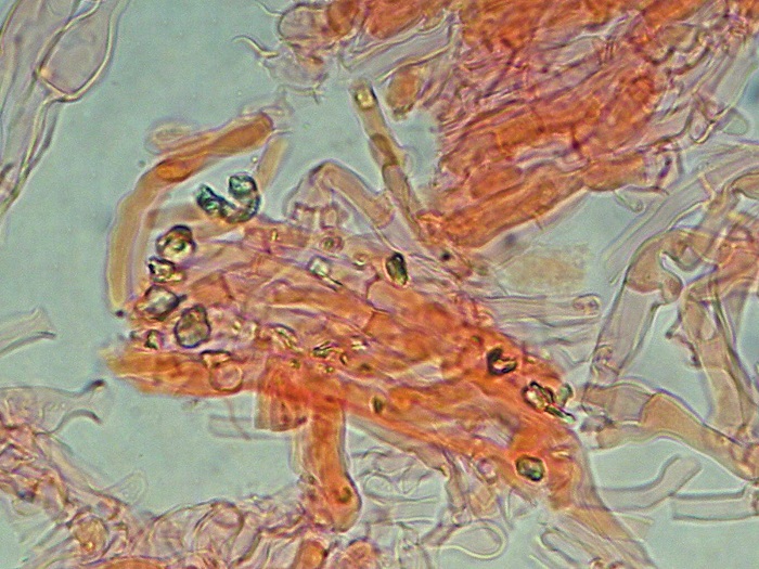 Sistotrema octosporum?