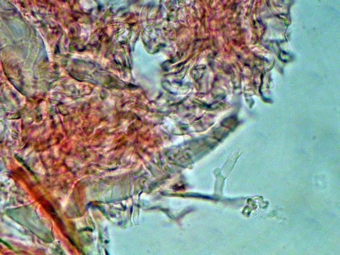 Litschauerella clematitis (Bourdot & Galzin) J. Erikss. & Ry