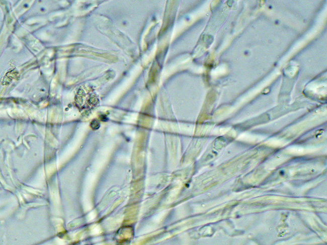 Gloeocystidiellum karstenii? (Laxitextum bicolor)