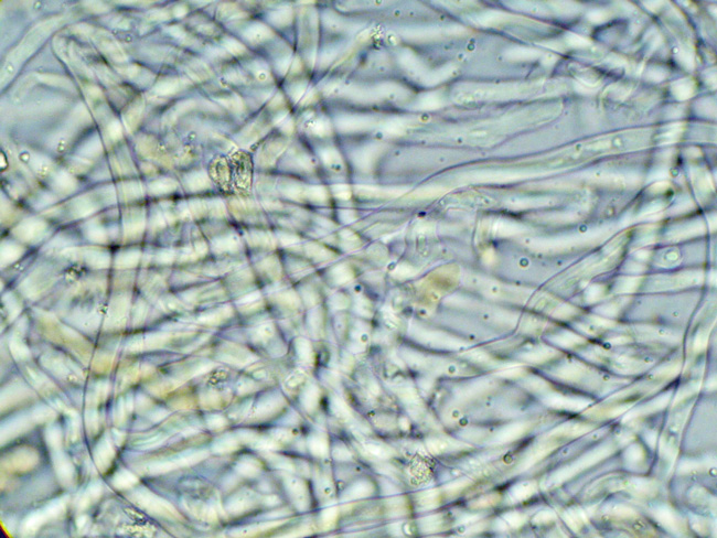 Gloeocystidiellum karstenii? (Laxitextum bicolor)