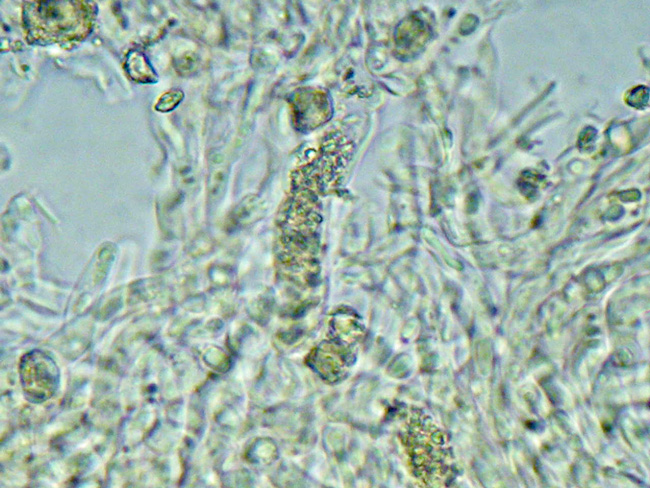 Gloeocystidiellum karstenii? (Laxitextum bicolor)