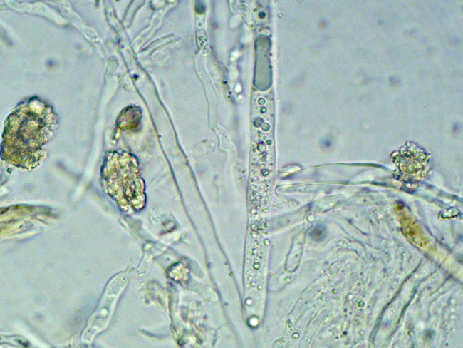 Gloeocystidiellum karstenii? (Laxitextum bicolor)