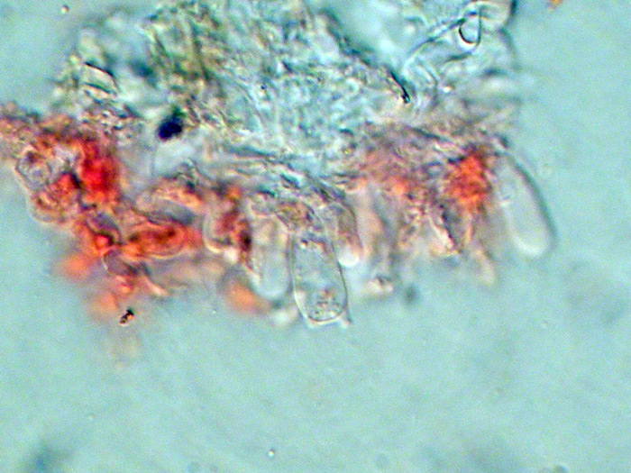 Phlebiella...(Phlebiella ardosiaca)