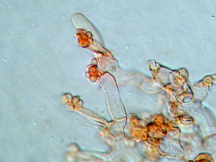 Botryobasidium pruinatum (Bres.) J. Erikss.