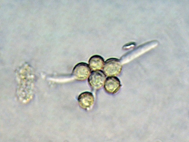 Litschauerella clematitis (Bourdot & Galzin) J. Erikss. & Ry