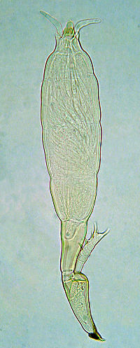 Adalia bipunctata parassitata da fungo (Laboulbeniaceae)