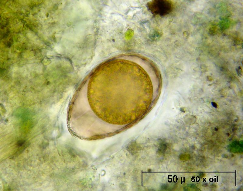 che cosa è ? - Euglypha sp.