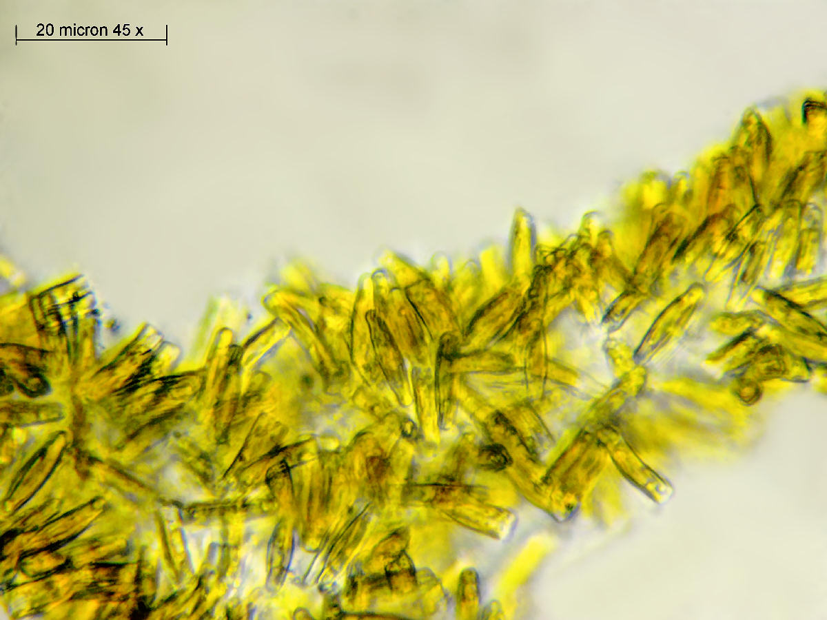cianobatteri incrostati da diatomee