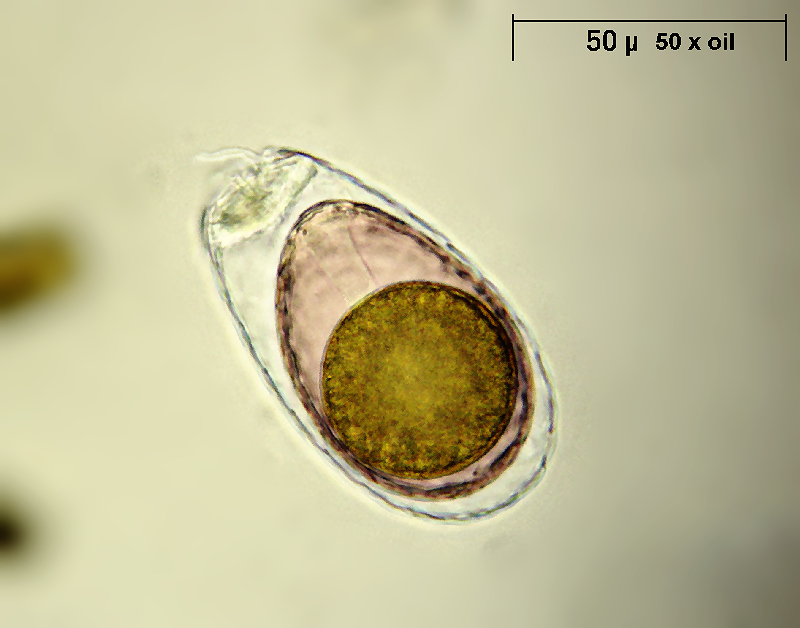che cosa è ? - Euglypha sp.