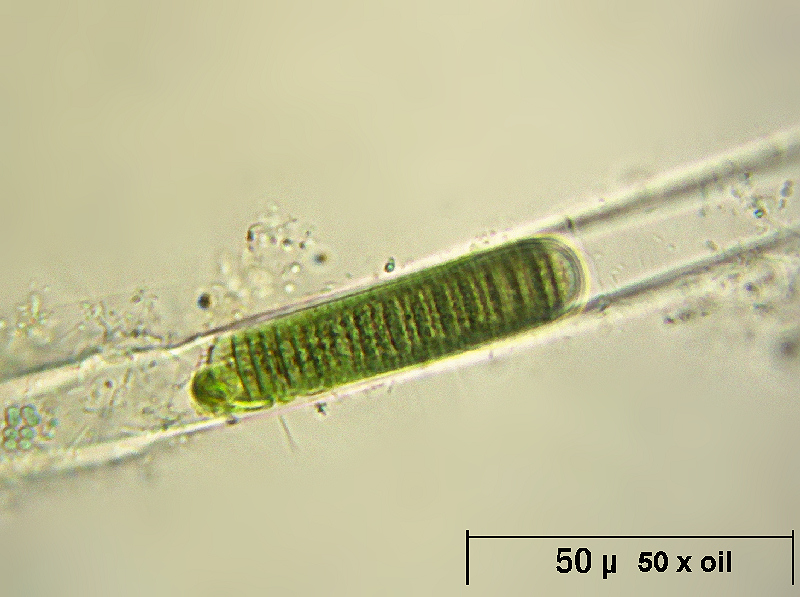Lyngbya sp.