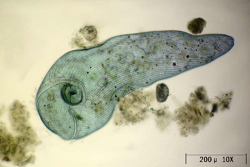 Stentor coeruleus - superficie esterna