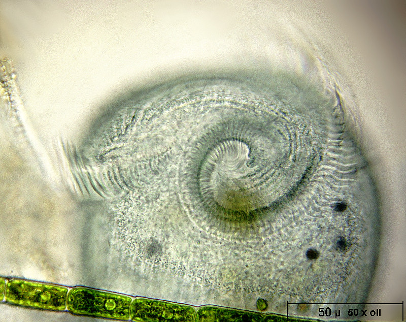 Stentor coeruleus - particolari frontali