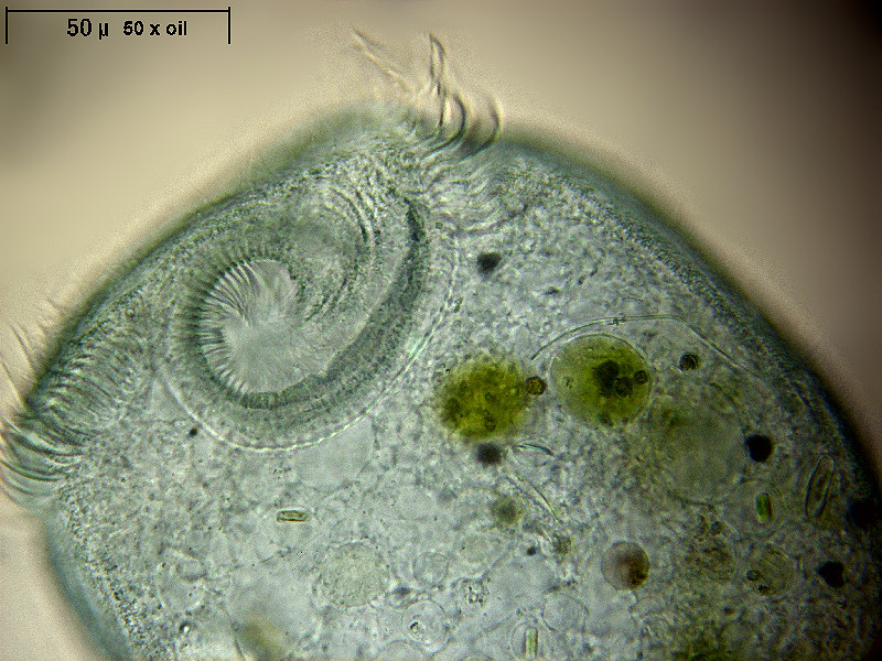 Stentor coeruleus - particolari frontali