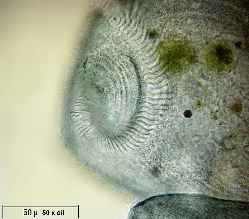 Stentor coeruleus - particolari frontali