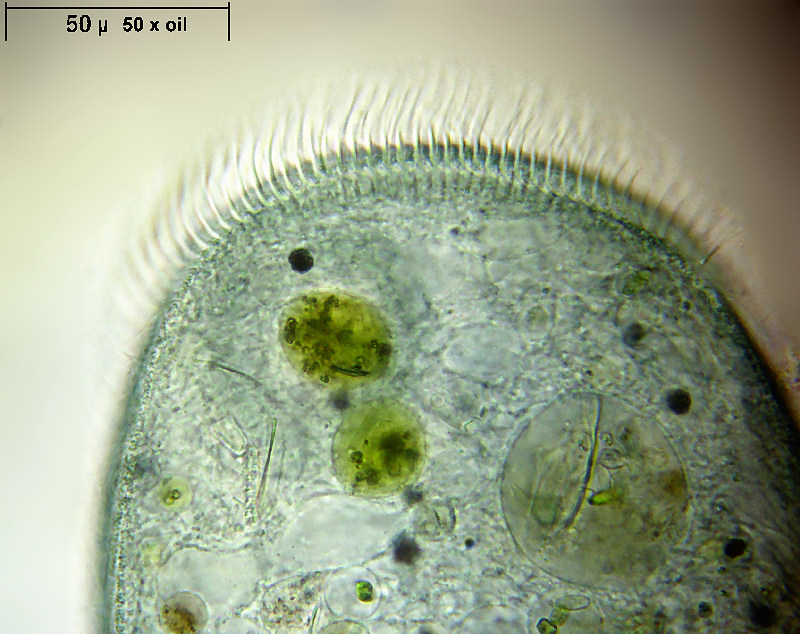 Stentor coeruleus - particolari frontali