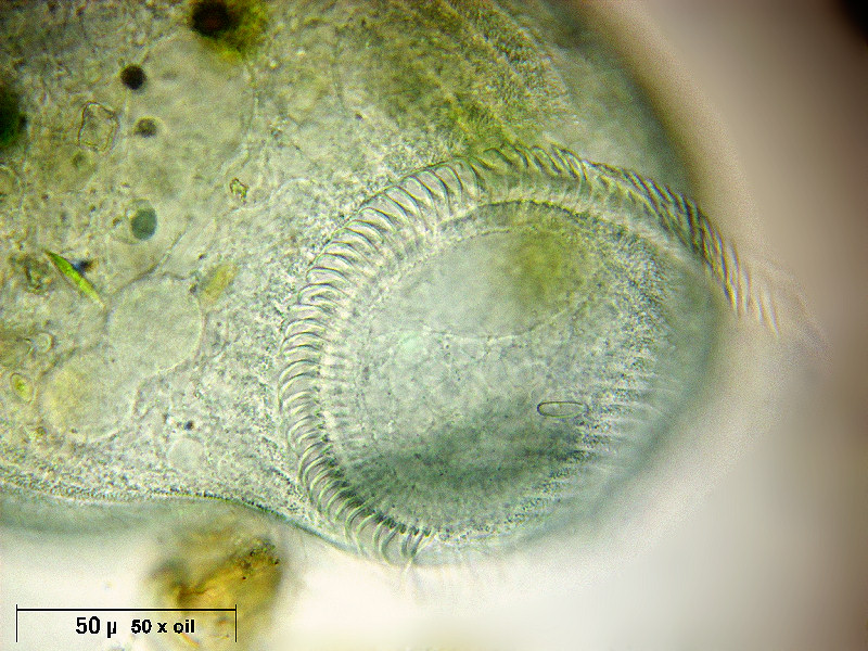 Stentor coeruleus - particolari frontali