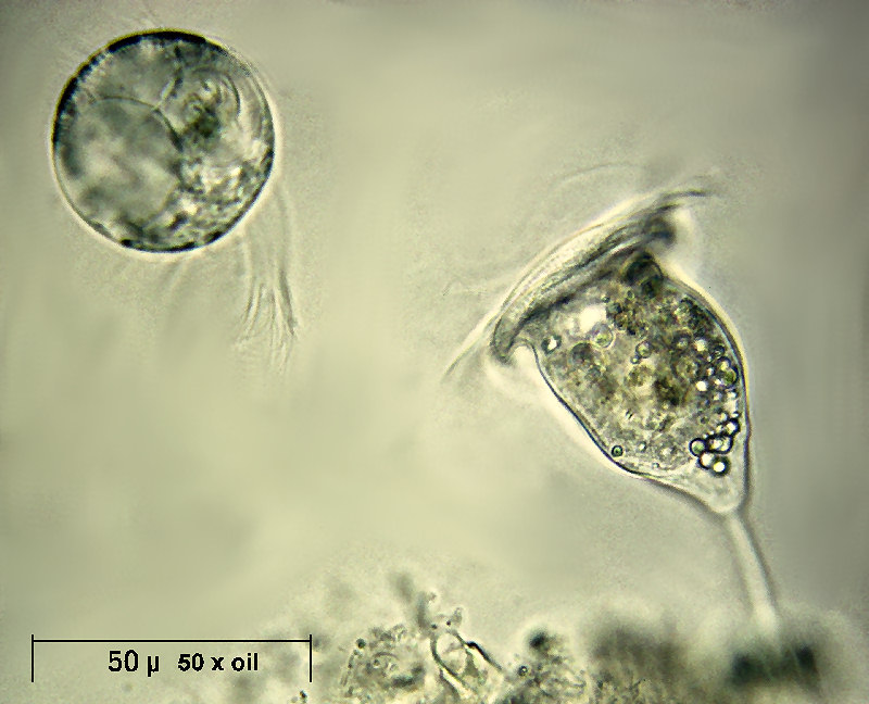 Askenasia alle prese con una vorticella