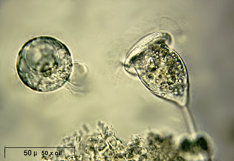 Askenasia alle prese con una vorticella