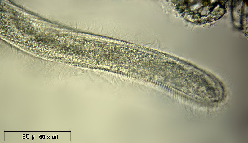Spirostomum sp.