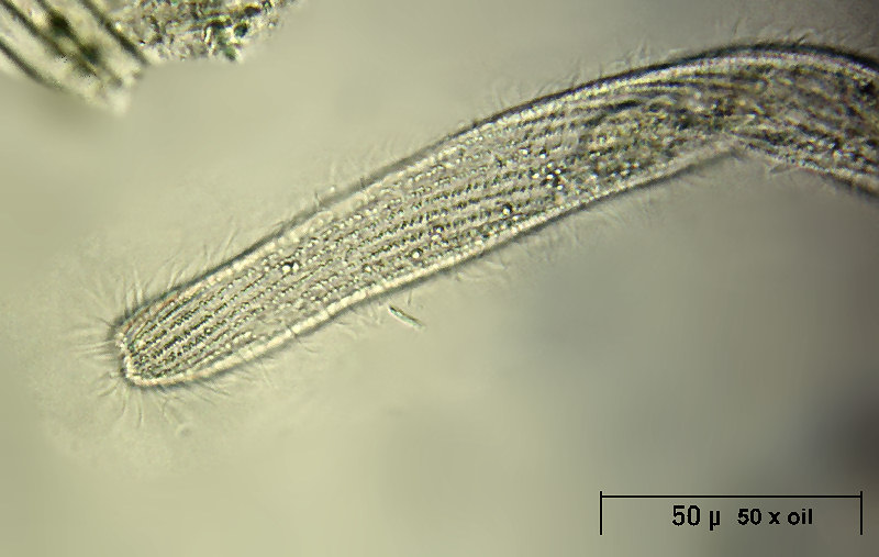 Spirostomum sp.