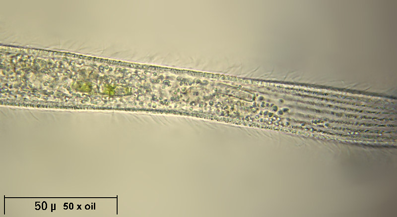 Spirostomum sp.