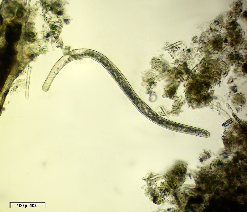 Spirostomum sp.
