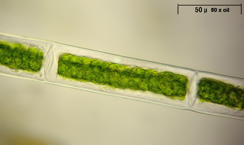 Mougeotia sp.