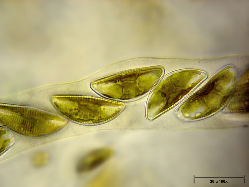 Encyonema caespitosus