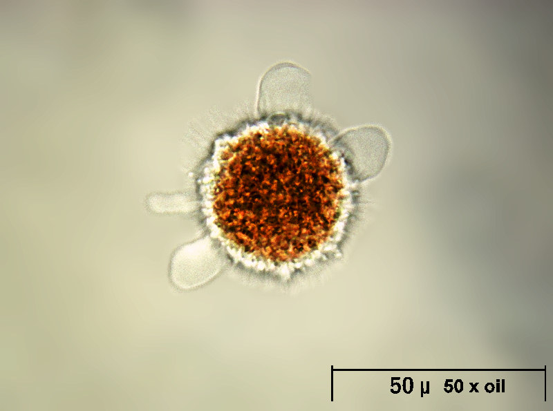 Vampyrella lateritia