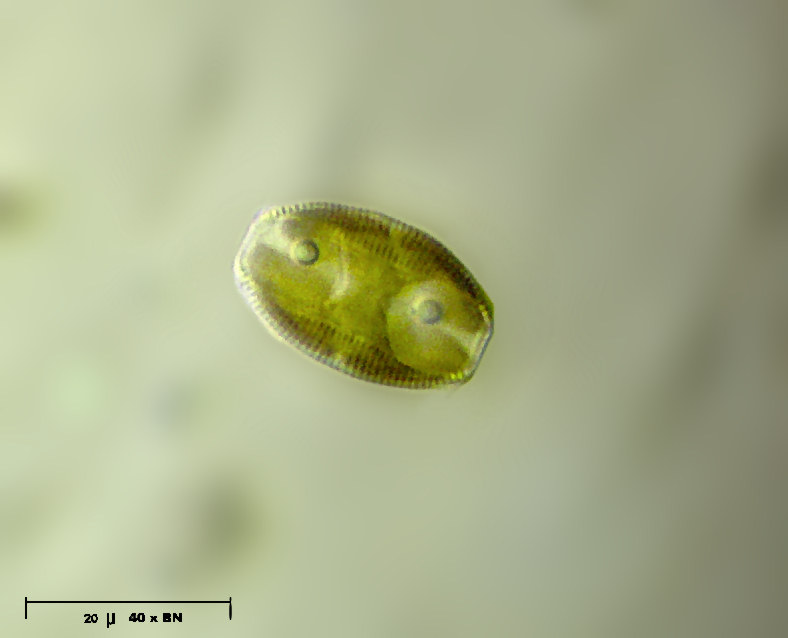Amphora ovalis