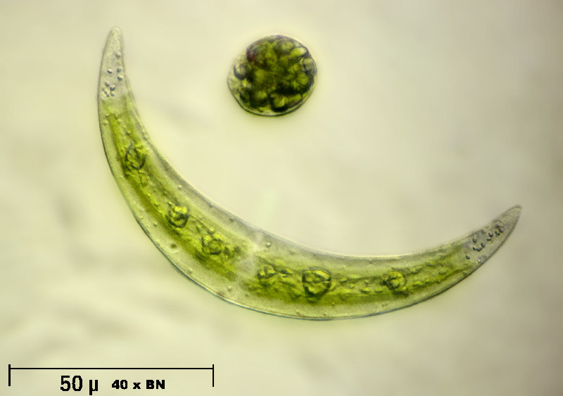 Closterium leibleinii
