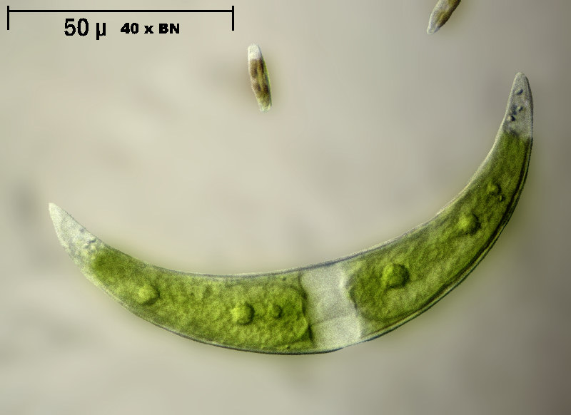 Closterium leibleinii