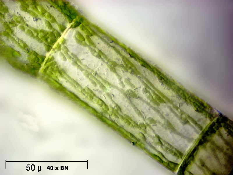 Sirogonium sp.