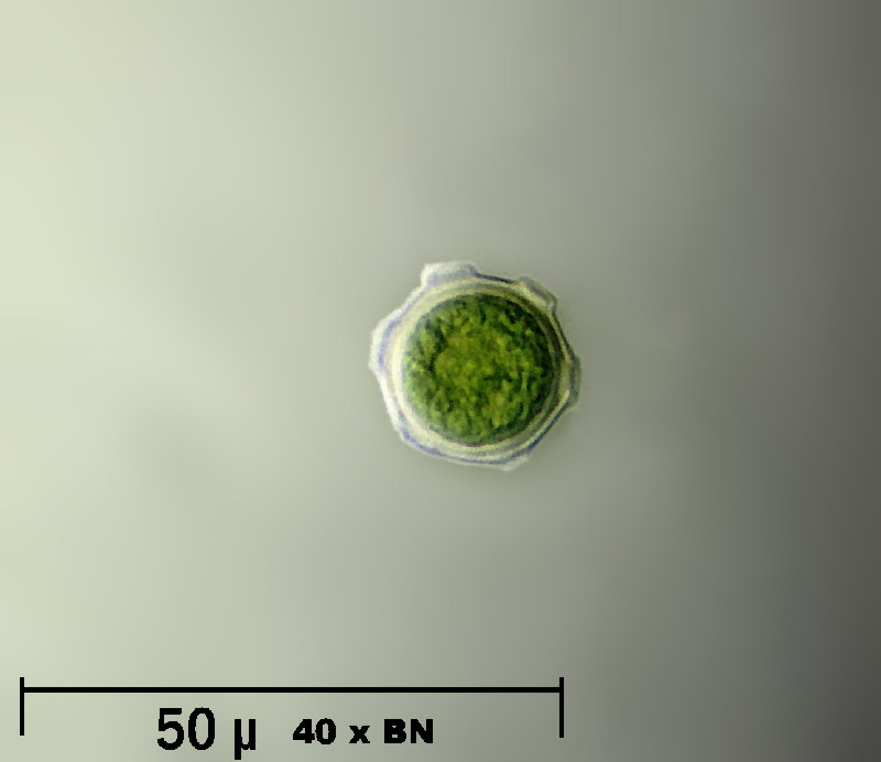 Coelastrum reticulatum