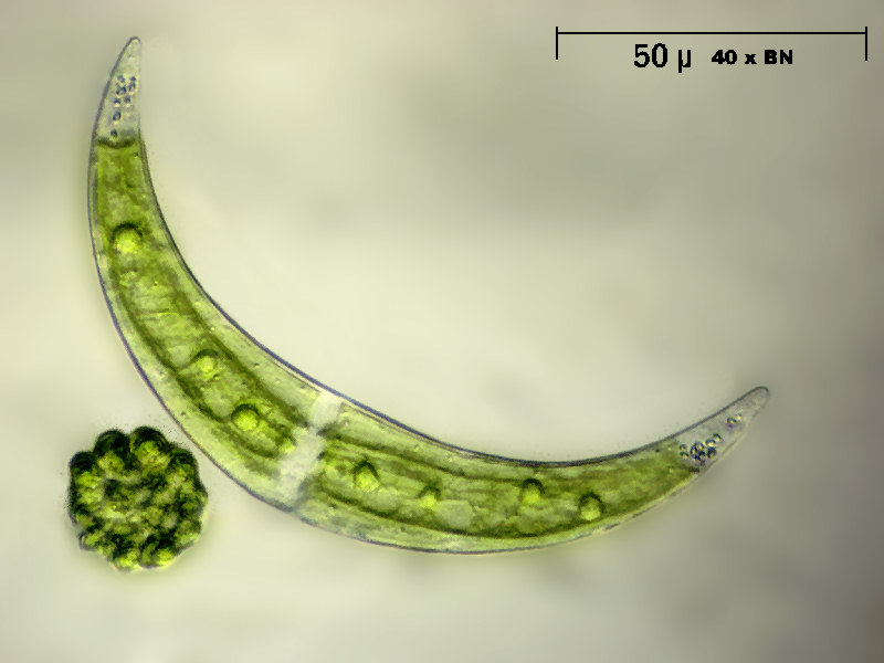 Closterium sp.