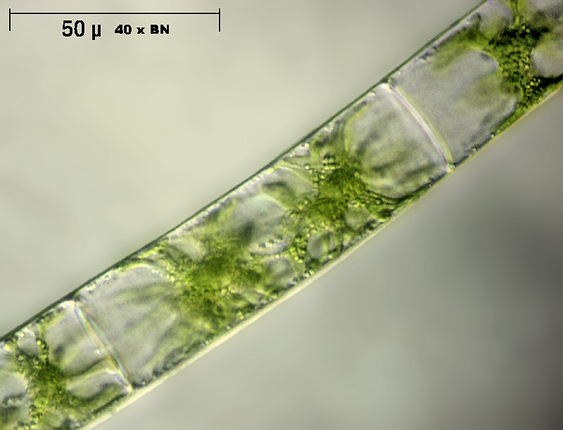 Zygnema sp.