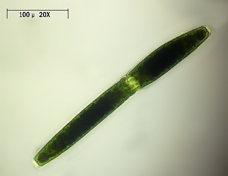 Pleurotaenium trabecula