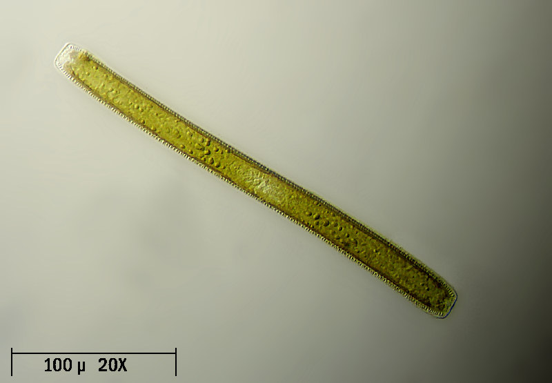 Un altra Nitzschia sigmoide