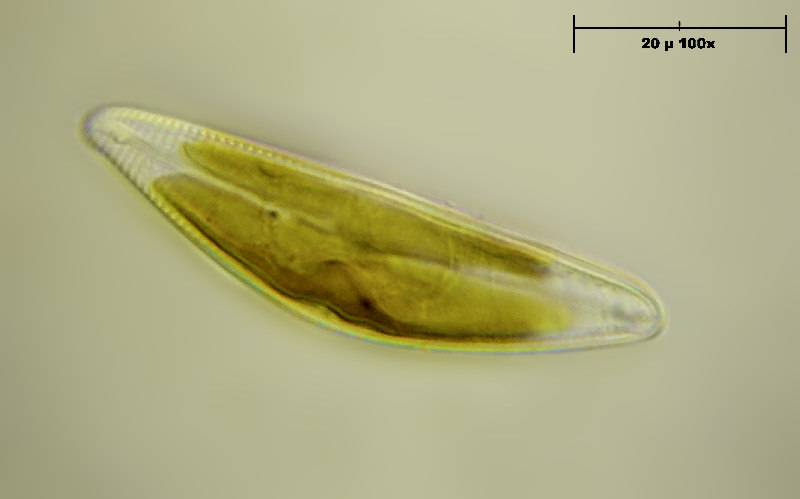 Encyonema sp.