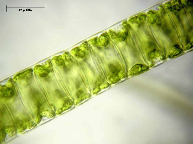 Ulothrix sp.
