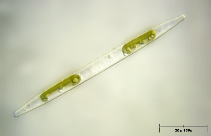 Nitzschia sp.