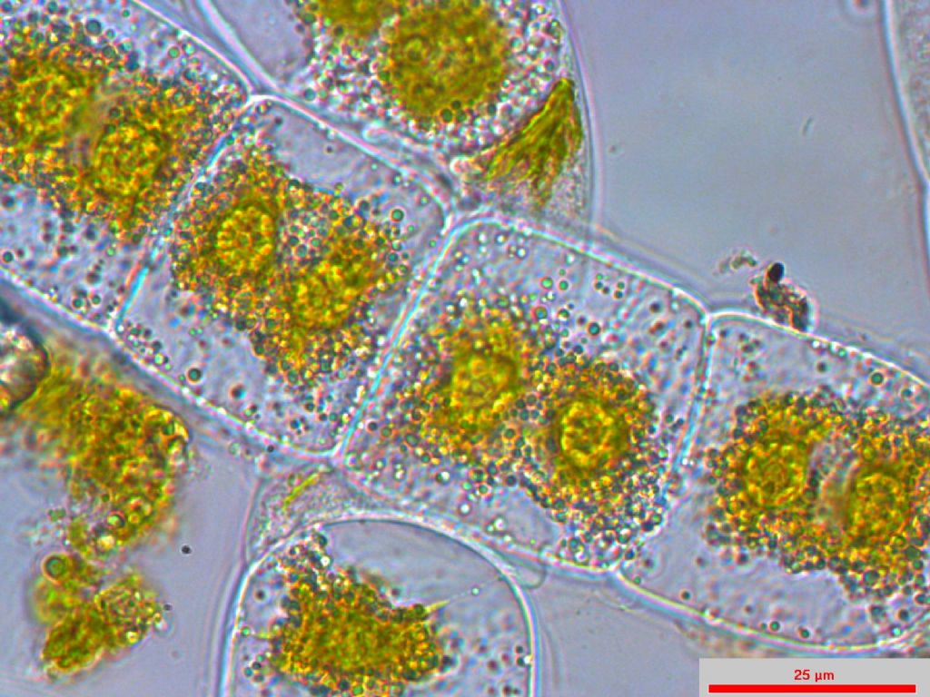 Alga filamentosa