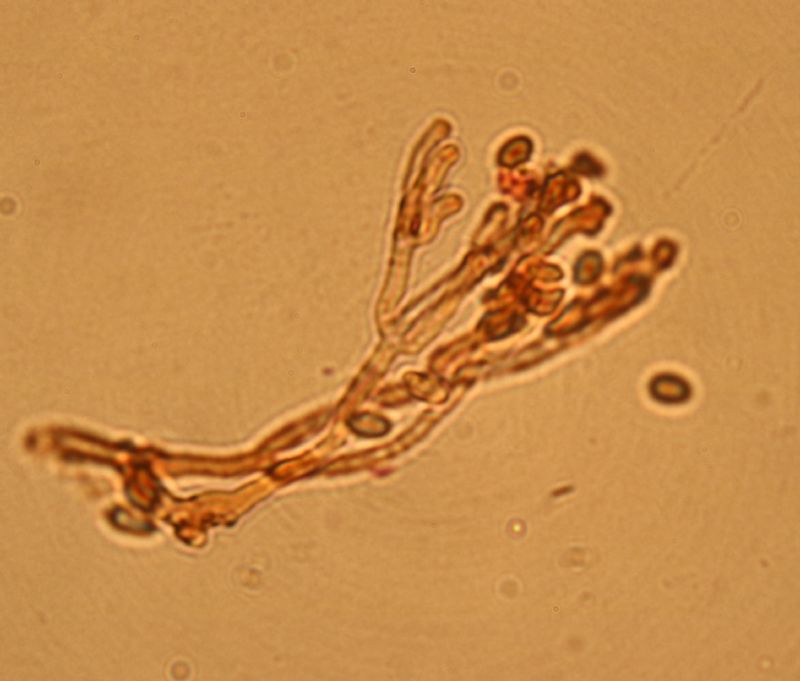 Myxo forma pseudoaethelium caffelatte