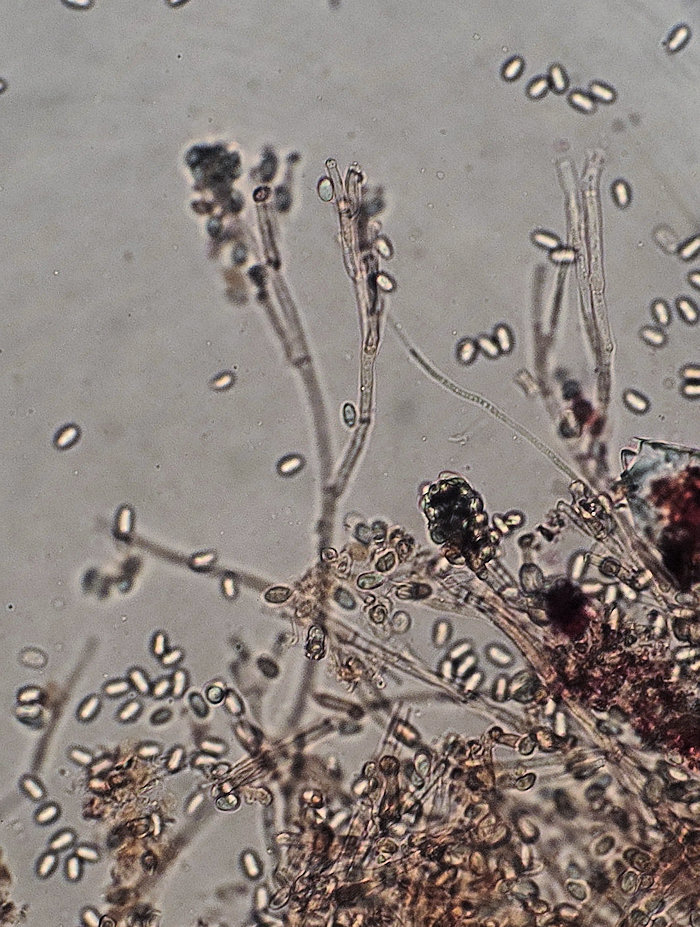 Myxo forma pseudoaethelium caffelatte